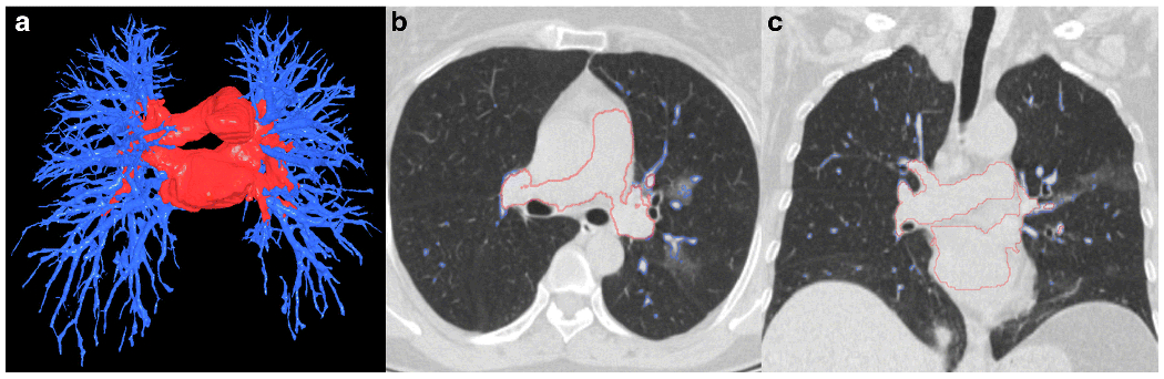 Figure 3: