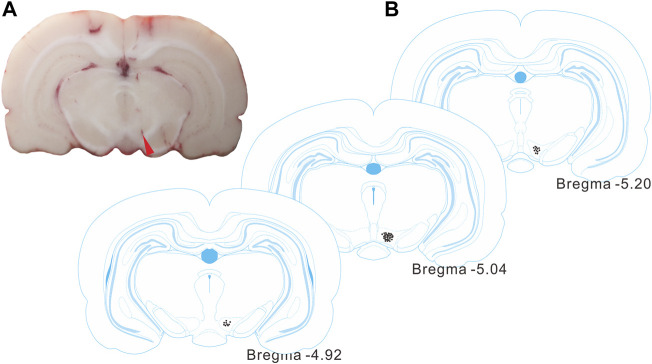 FIGURE 3