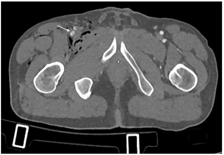 Figure 6