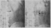 130