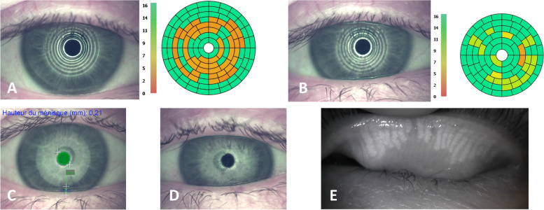 Fig. 3