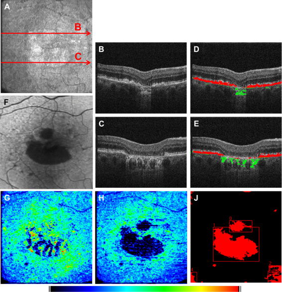 Fig. 13