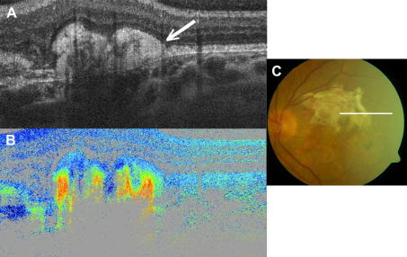 Fig. 14