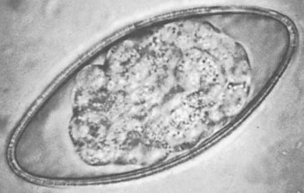 Figure 3.52