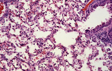 Figure 3.24