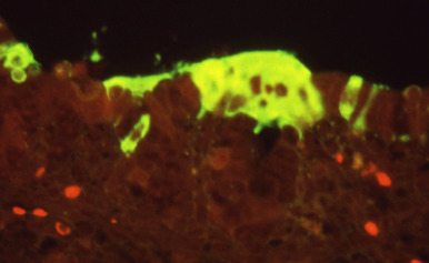Figure 3.26