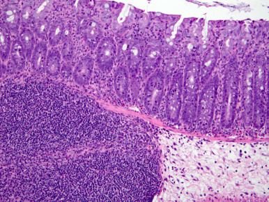 Figure 3.39