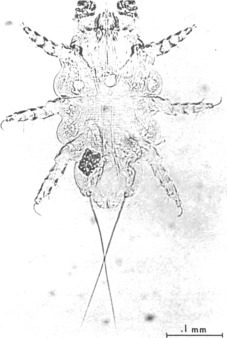 Figure 3.56