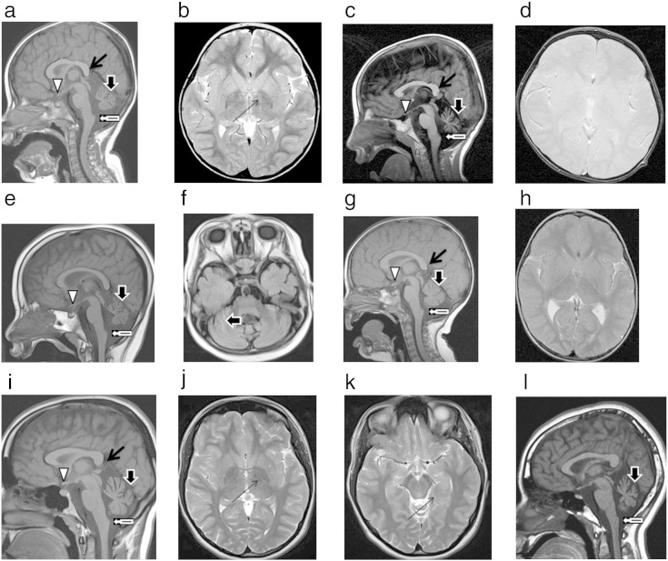 Fig. 1