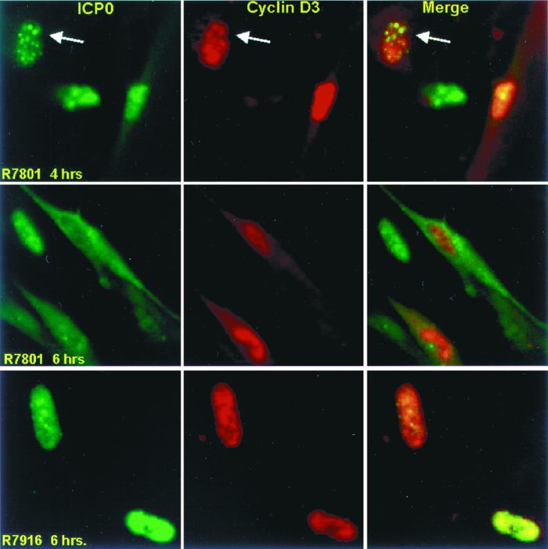 FIG. 11