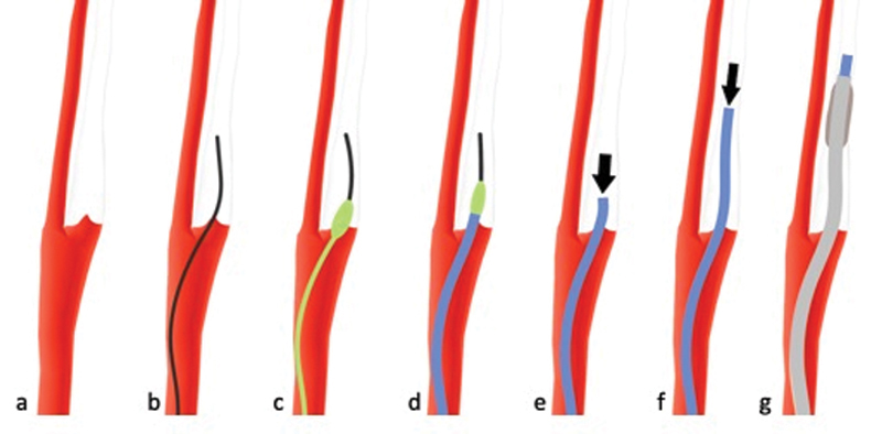 Fig. 11