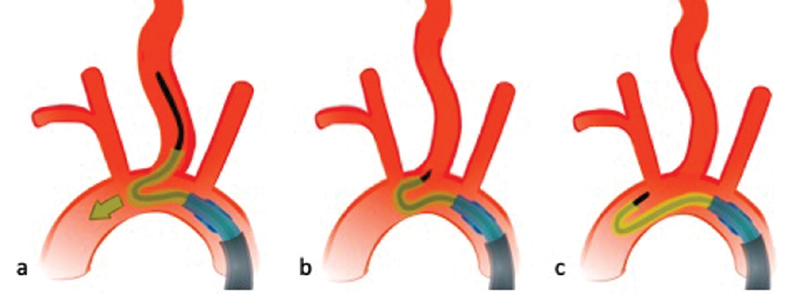 Fig. 15