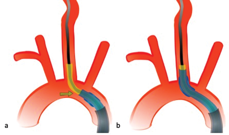 Fig. 14