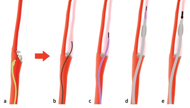 Fig. 12