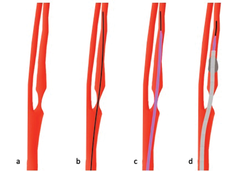 Fig. 9