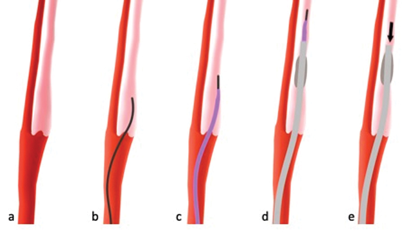 Fig. 10