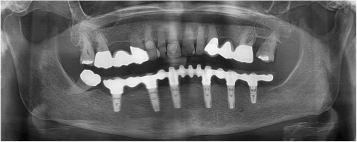 Fig. 16