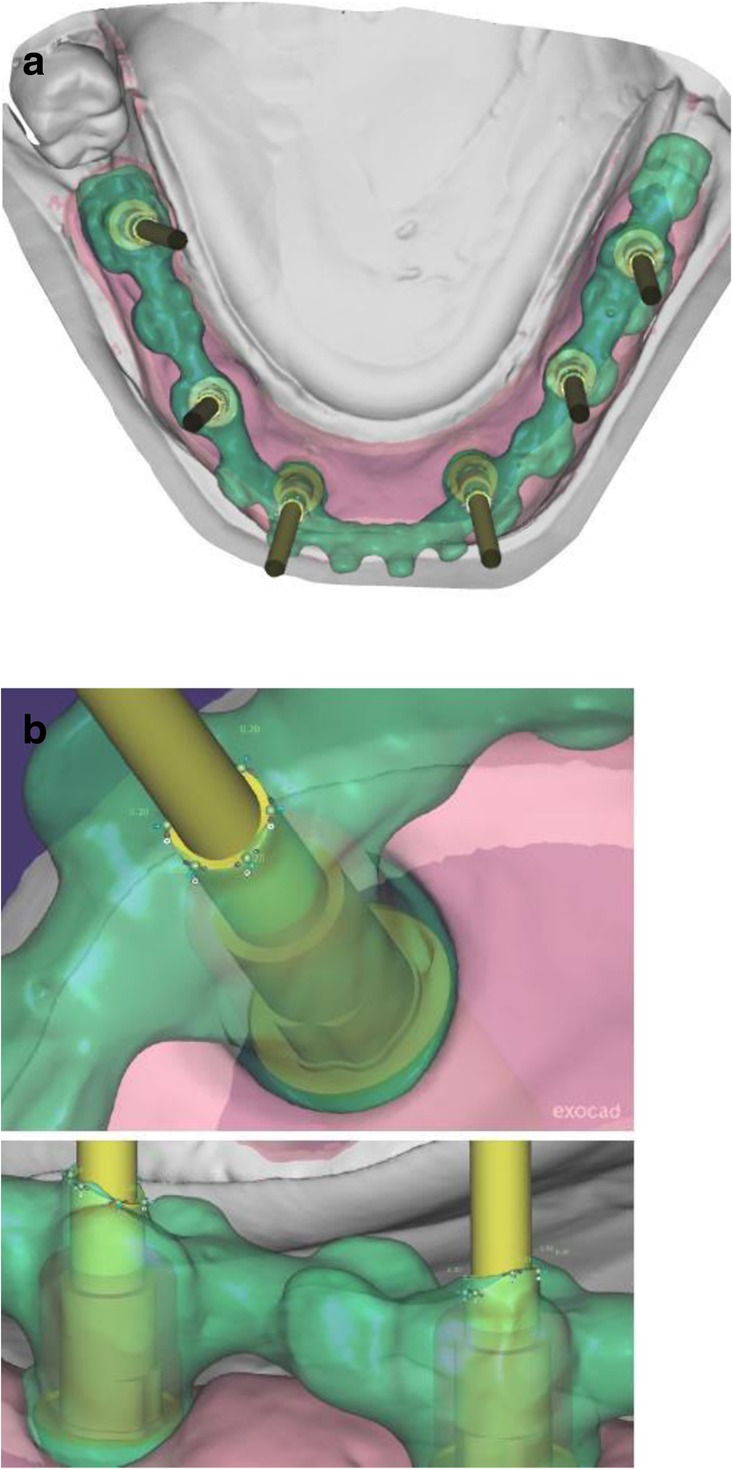 Fig. 6