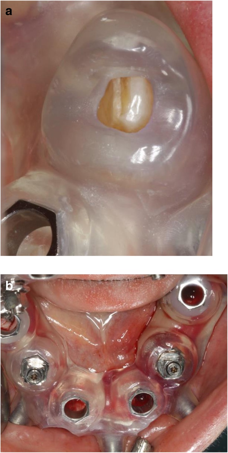 Fig. 8