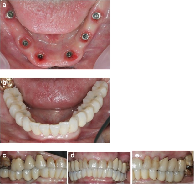 Fig. 14