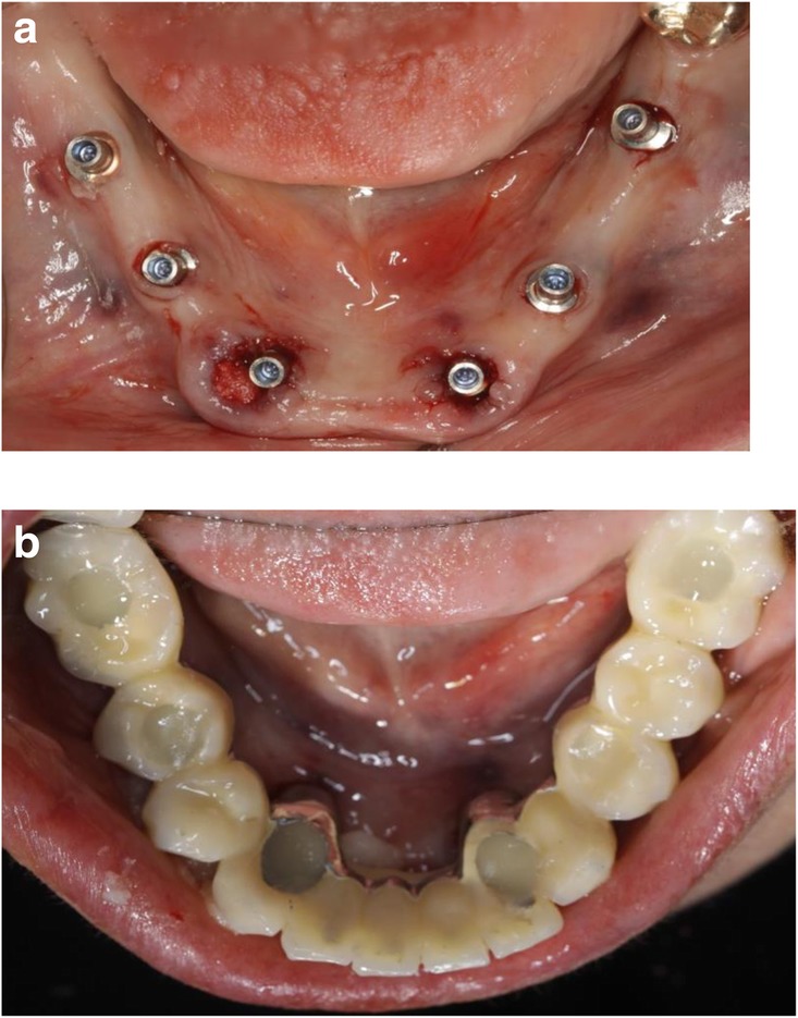 Fig. 9