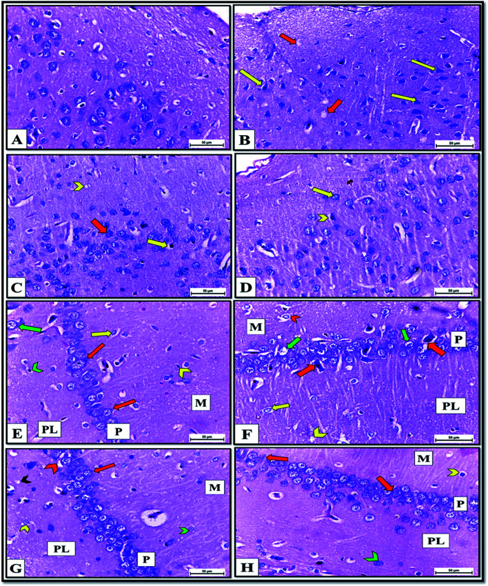 Fig. 11