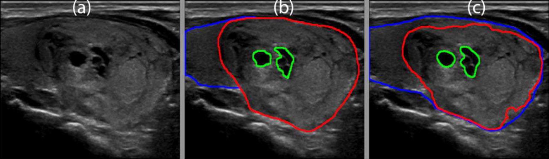 Fig. 15.