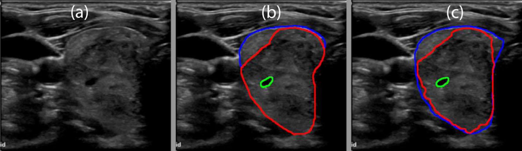 Fig. 14.