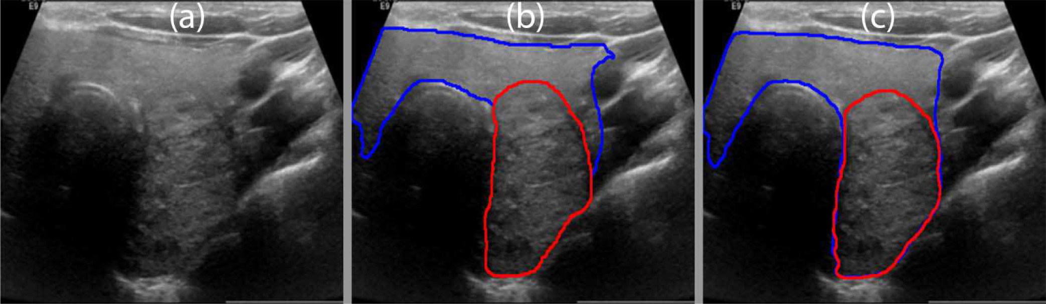 Fig. 13.