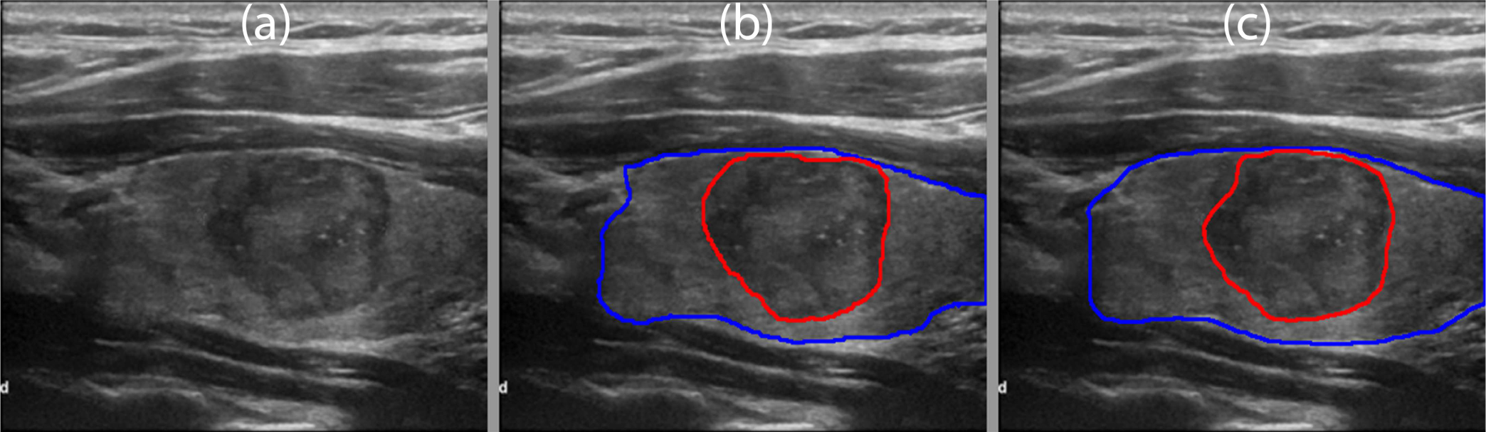 Fig. 17.