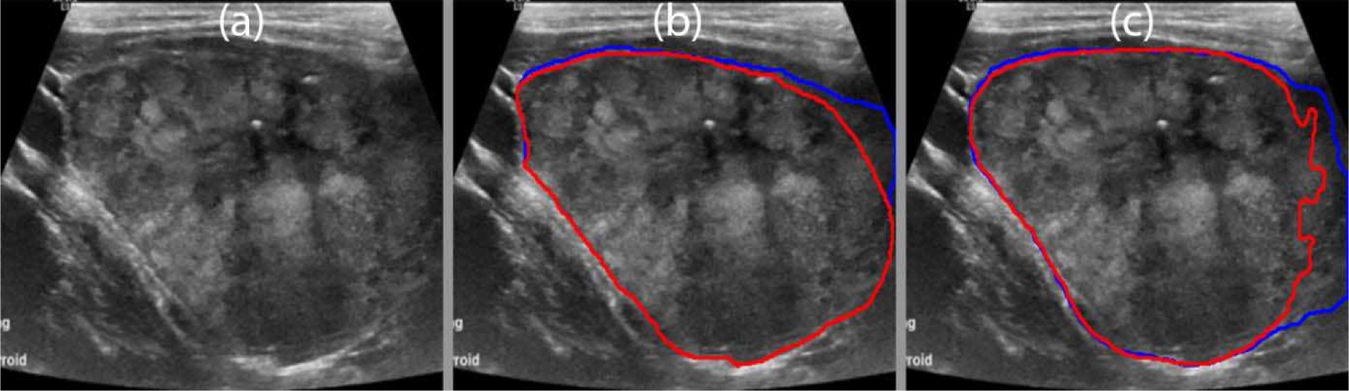 Fig. 16.