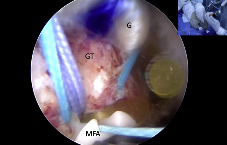 Fig 13