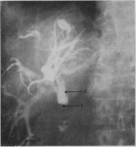 Fig. 6(a)