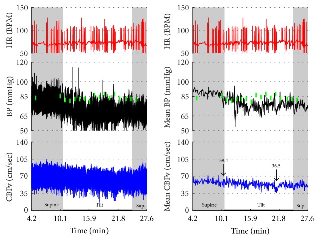 Figure 21