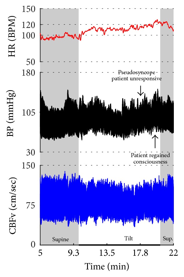 Figure 22