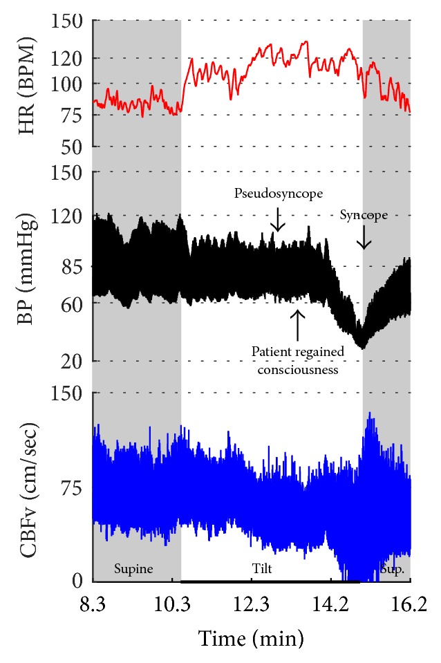 Figure 23