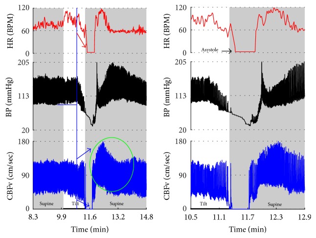 Figure 11