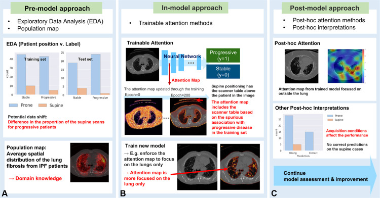 Example of applying explainability to detect and mitigate data shift in the IPF progression classification model. (A) Premodel approach. (B) In-model approach. (C) Postmodel approach.