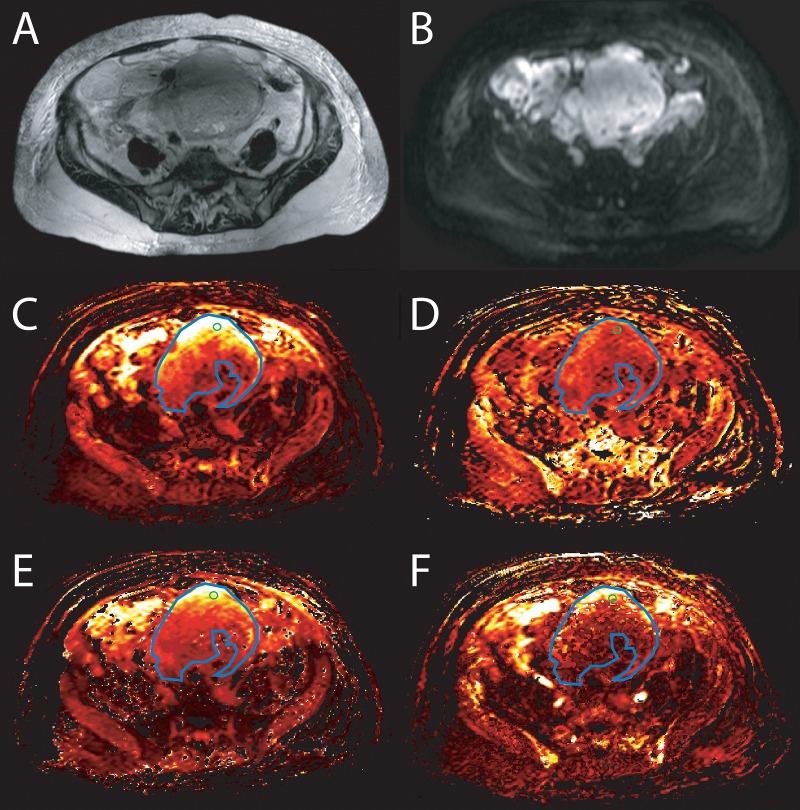 Fig 1