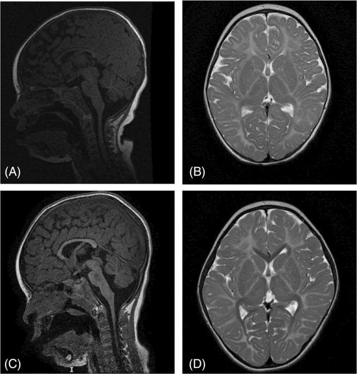 FIGURE 3