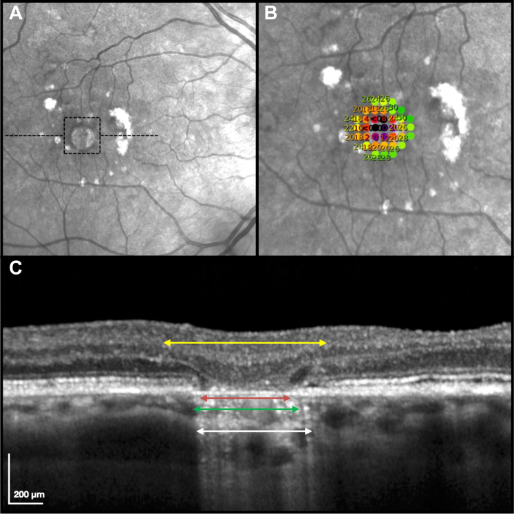 Figure 1