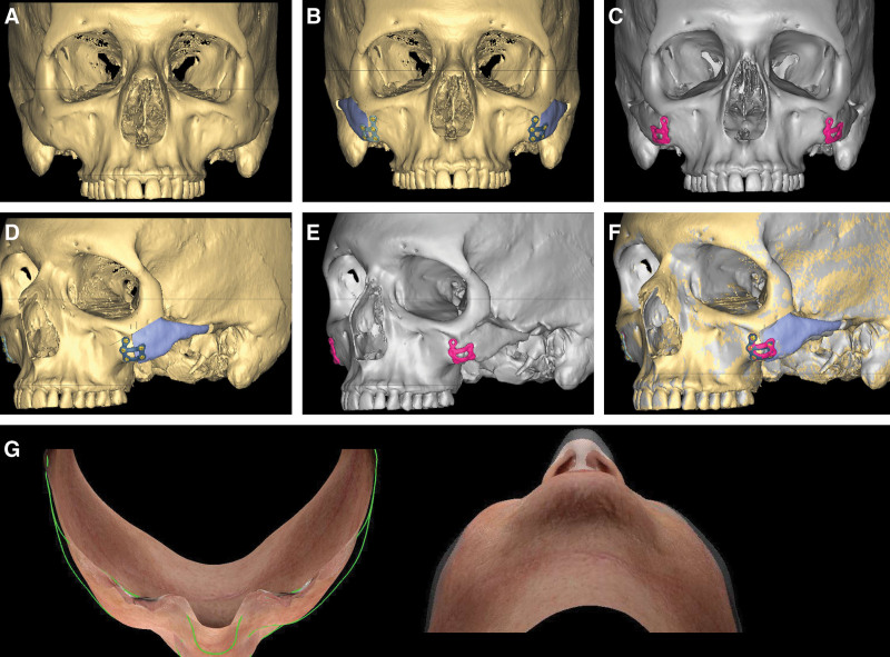 Fig. 3.