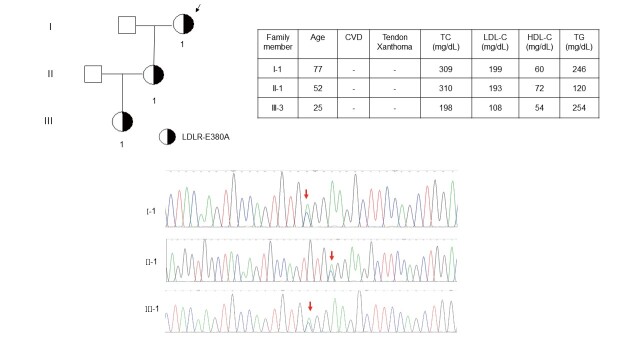 
Fig.4. Family pedigree of LDLR c.1139 A＞C (p.E380A)
