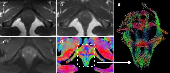 Fig. 1