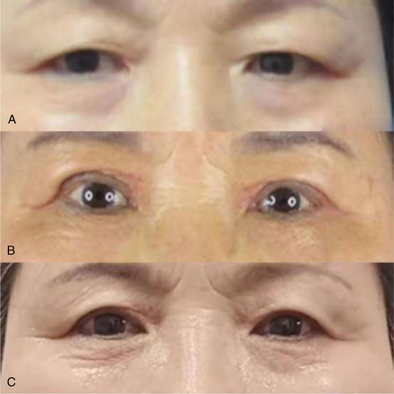 FIGURE 3