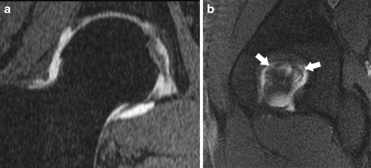 Fig. 15