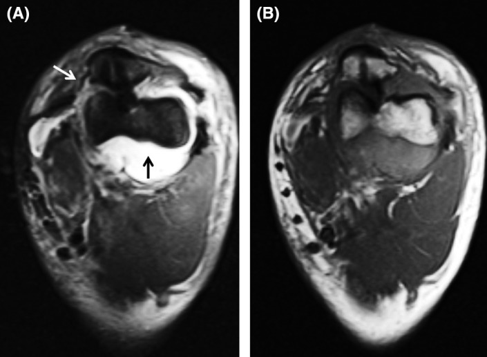 FIGURE 3