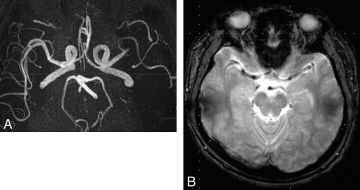 Fig 1.