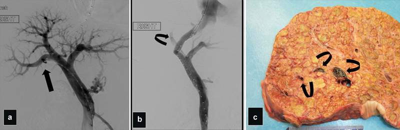 Fig. 17