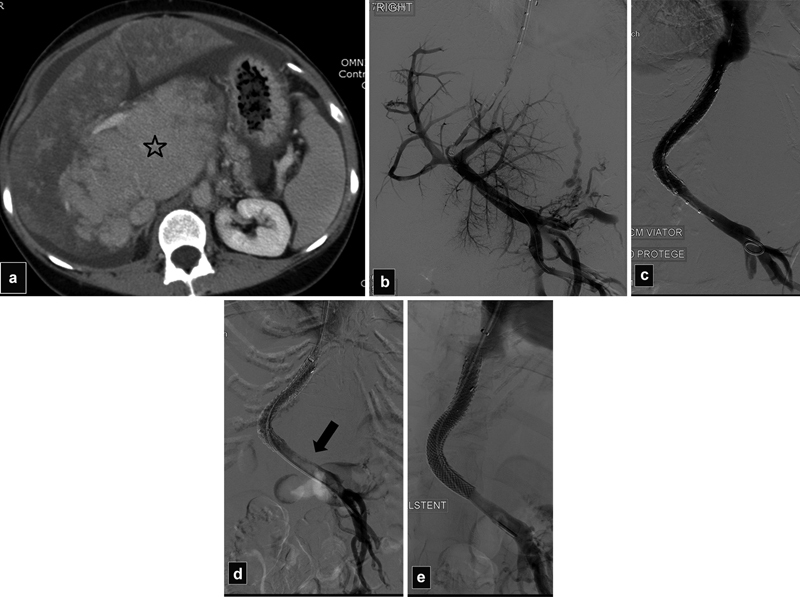 Fig. 26